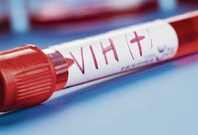 Reforma eliminaría consentimiento informado escrito en pruebas de VIH